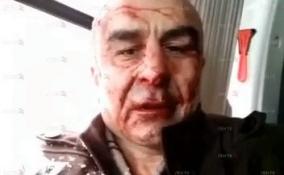 Видео: задержанный стрелок, ранивший сотрудника ОМОН в Петербурге, даёт показания