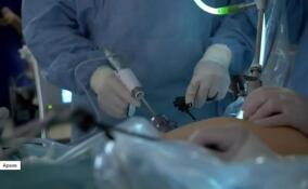 В Гатчинской больнице впервые удалили аппендицит беременной женщине методом лапароскопии