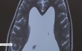 В России стартовала неделя сохранения здоровья головного мозга