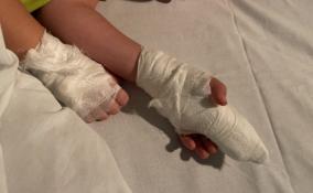 Мальчику, который травмировался на карусели в детсаду Кудрово, могут ампутировать палец