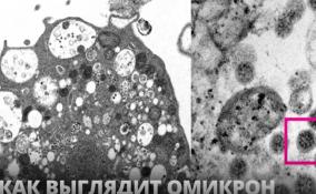 Учёные из Гонконга опубликовали микрофотографию клетки
почки обезьяны после заражения омикрон-штаммом
