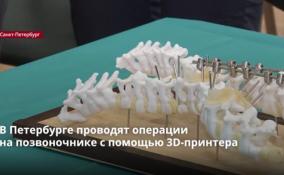 В Петербурге проводят операции
на позвоночнике с помощью 3D-принтера